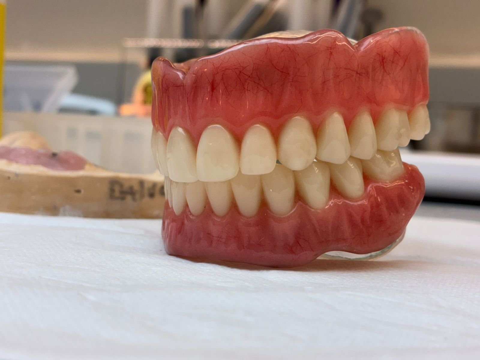 Imagem ilustrativa de Prótese Overdenture 1