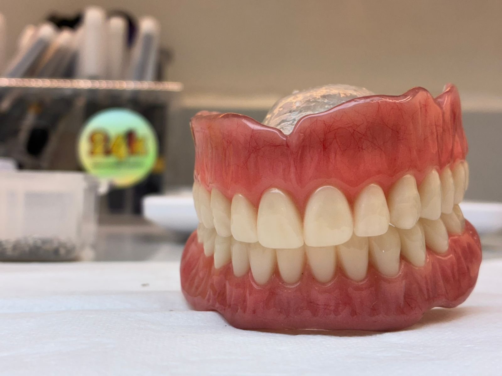 Sorriso natural com Prótese Overdenture